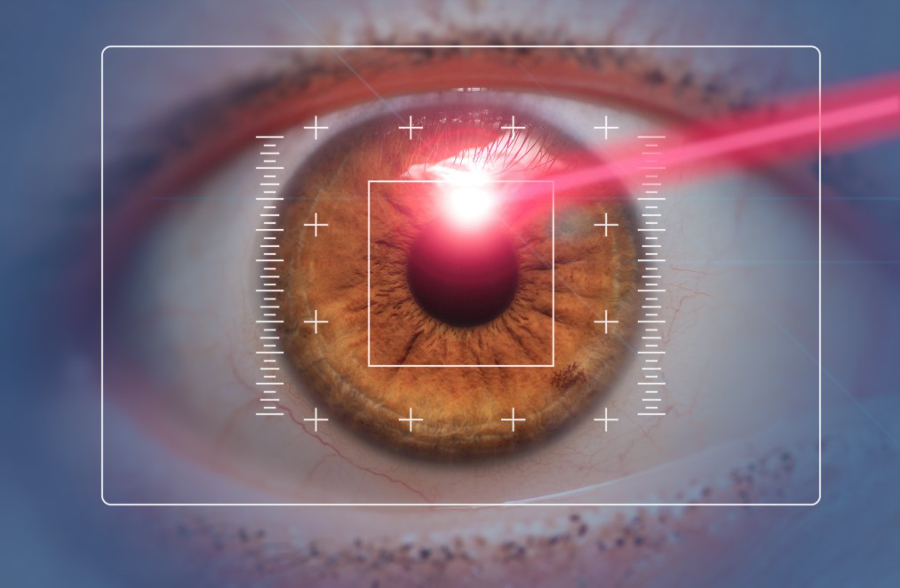 chirurgien lasik